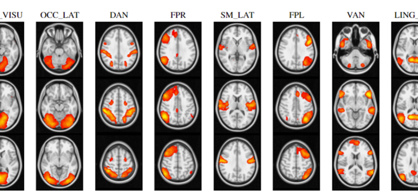 Brain imaging slices highlighting regions used in network analysis